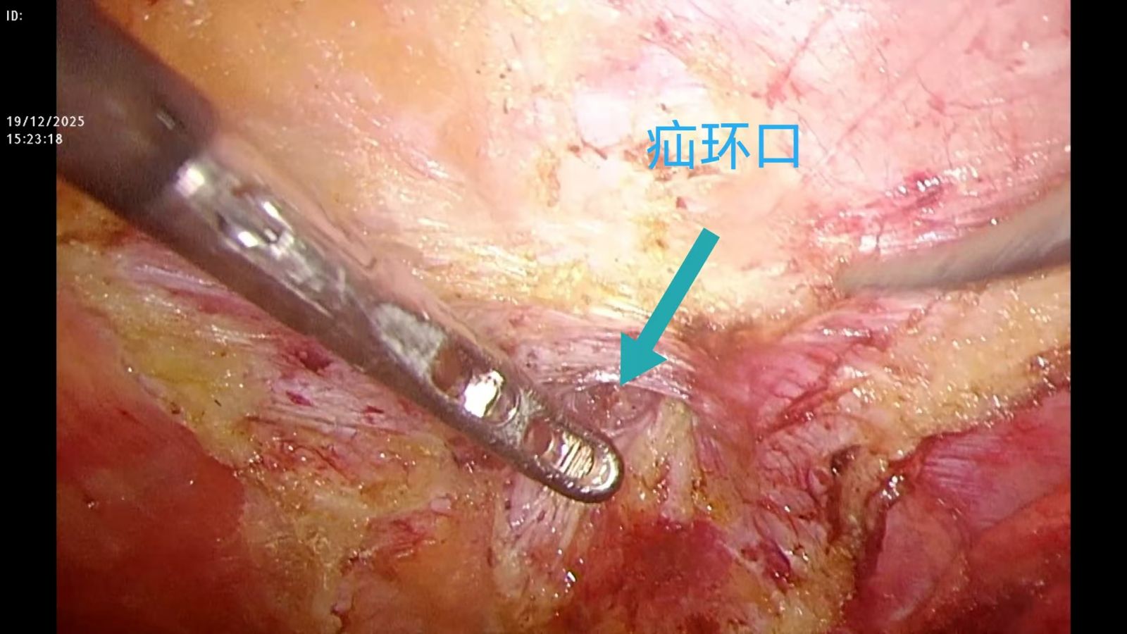 微信图片_20260320101228_1005_195.jpg